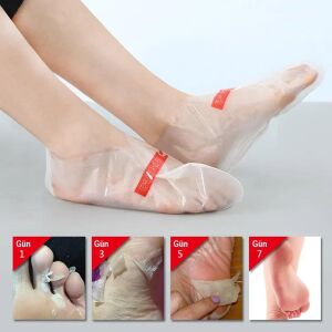 Sunup SN-26965 Ayak Peeling Maskesi